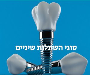 סוגי השתלות שיניים בארץ בחול